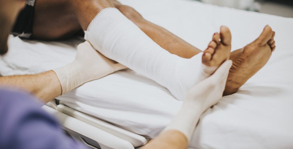 Fracture Treatment in hyderabad
