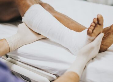 Fracture Treatment in hyderabad