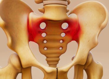 Conceptual 3D illustration of a sacroiliac joint inflammation