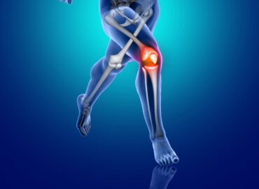 3D render of a male medical figure running with knee bone highlighted