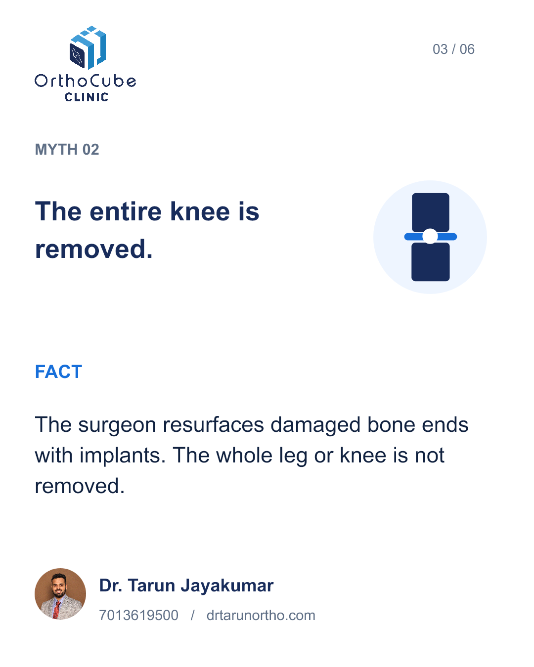 Knee replacement myths and facts in English – slide 3