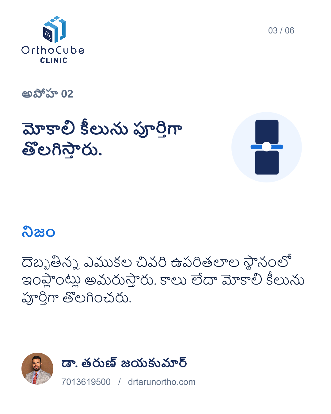 మోకాలి మార్పిడి అపోహలు మరియు నిజాలు – స్లైడ్ 3